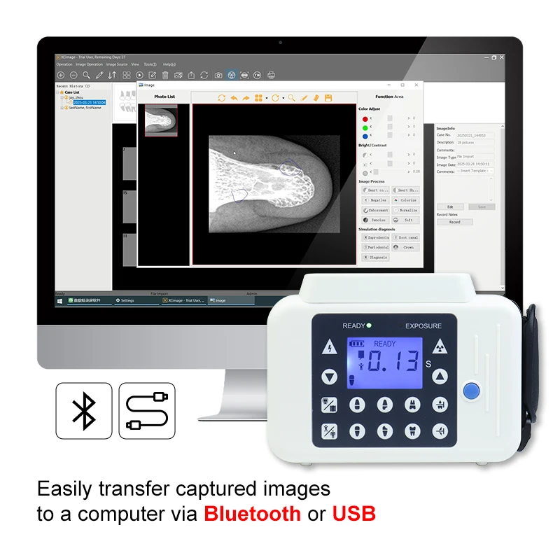 Portable Dental X Unit Ray Machine with Screen+Digital X Sensor Size 2.0