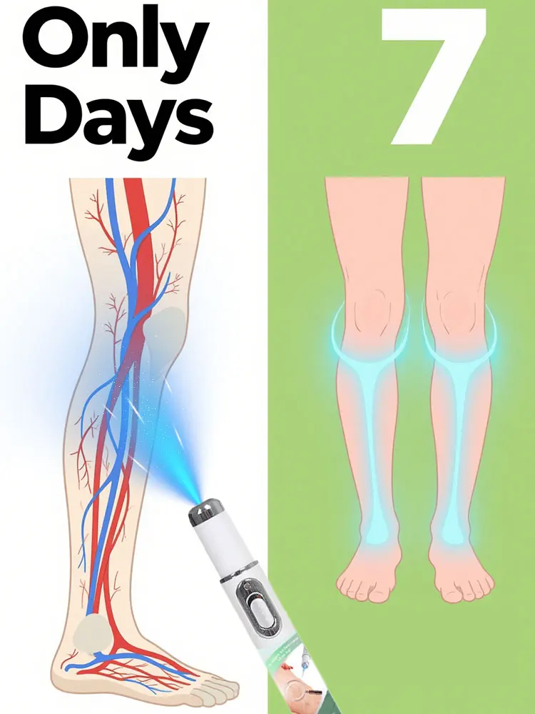 الليزر إلى الأرجل العنكبوتية الدوالي في 7 أيام #1