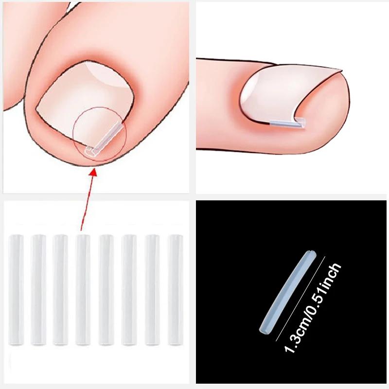 Narzędzie do korekcji wrastających paznokci, wkładka do wypełniania paznokci, leczenie wrastających paznokci, elastyczna plastra, klips prostujący, orteza, narzędzie do pedicure