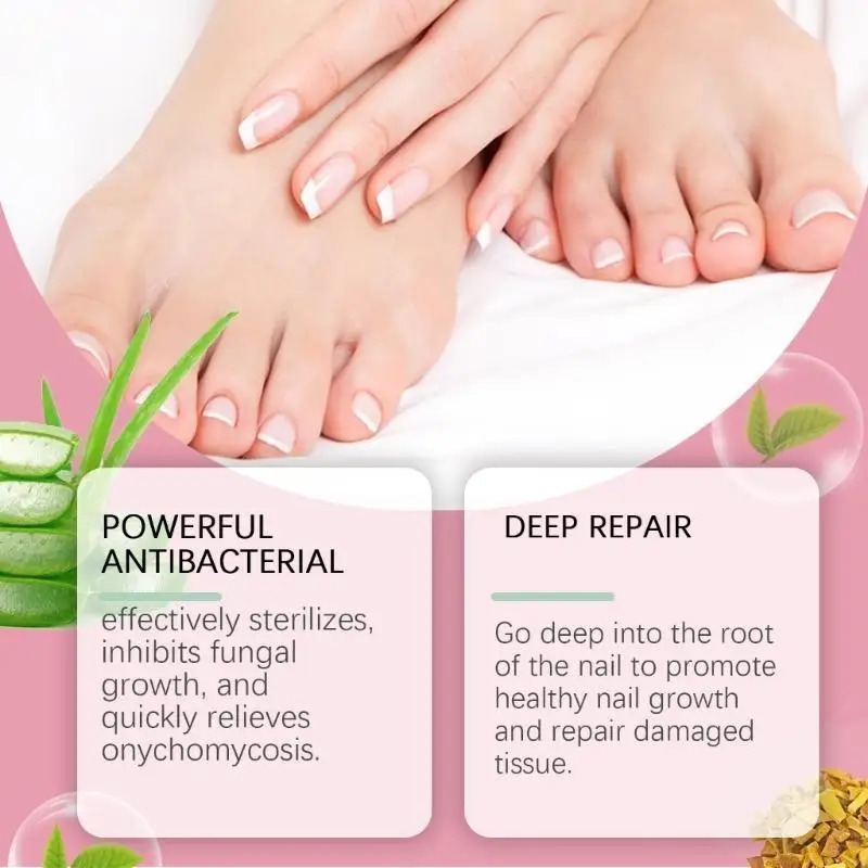 Zehennagel und Fingernägel für die Nägelwahrnehmung Flüssigkeit Mehrzwecknagelreparatur für verfärbte und beschädigte Nägel T4MB