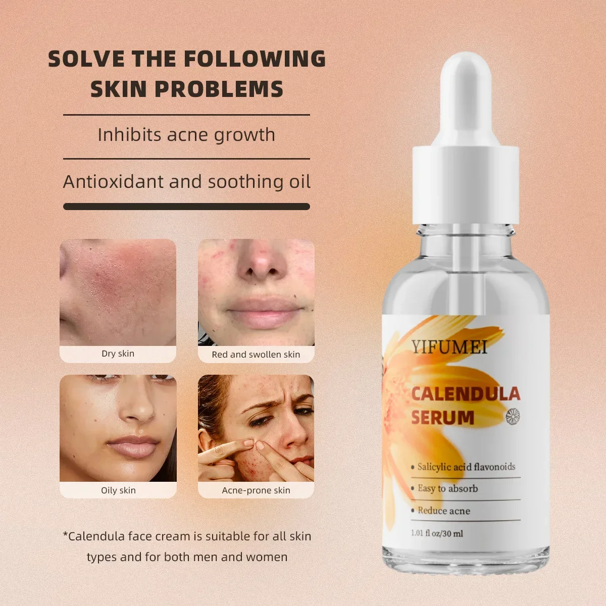 Moisturizing Face Serum Calendula Improves Skin Control Oil Anti-acne Centella Serum Moisturized Dry Nourish Winter Care New