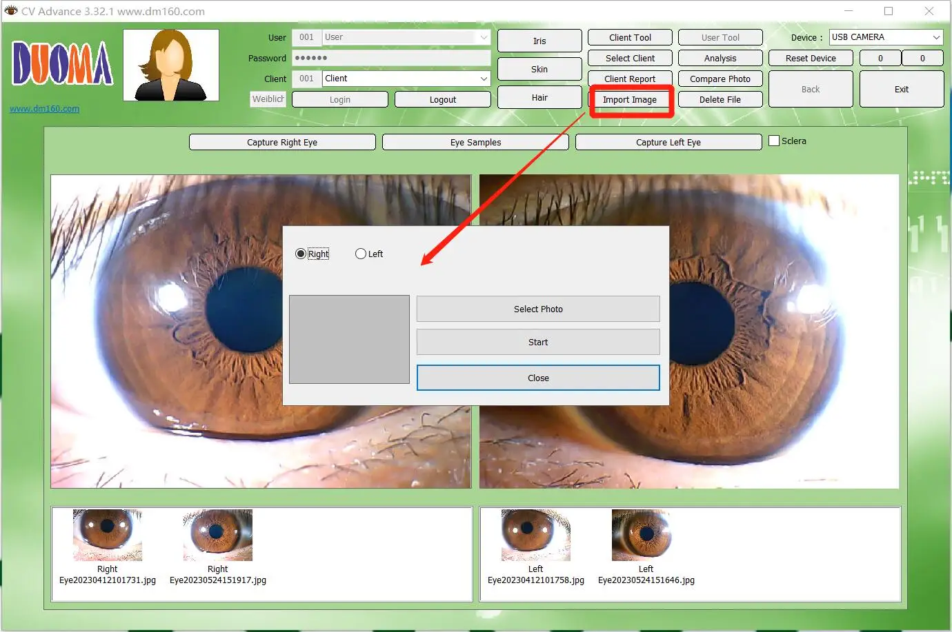 2025 Enhanced Version 12MP HD 30x Iris Lens Iris  Professional Pupil Analysis Health Detection Product Free User Manual