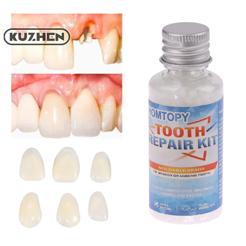 30ml Resin Tooth Repair Glue Shapeable Teeth Gaps Filling Solid Temporary Teeth Repair False Teeth Glue Safety Dental Supplies