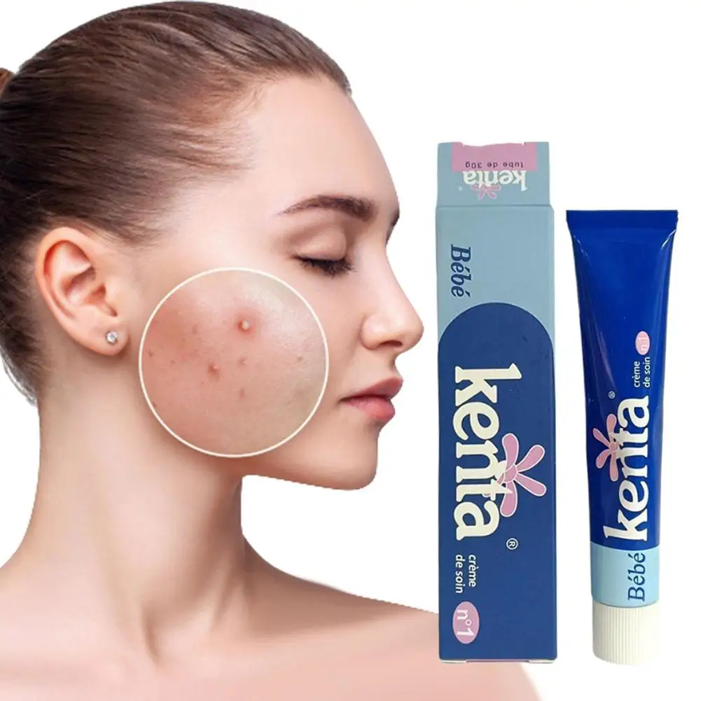 كريم تبييض مناسب للمناطق الحساسة يتلاشى علامات حب الشباب ترطيب دائم ترطيب يغذي العناية بالبشرة يتلاشى علامات حب الشباب #3