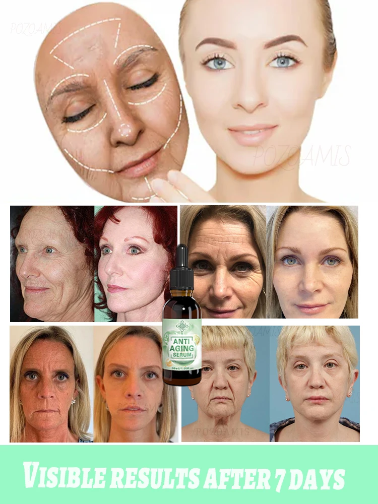 Wrinkles disappear A𝑛𝑡𝑖-𝑤𝑟𝑖𝑛𝑘𝑙𝑒 𝑒𝑠𝑠𝑒𝑛𝑐𝑒 𝑖𝑛𝑠𝑡𝑎𝑛𝑡𝑙𝑦 𝑟𝑒𝑚𝑜𝑣𝑒𝑠 𝑤𝑟𝑖𝑛𝑘𝑙𝑒𝑠 𝑙𝑖𝑓𝑡𝑠 𝑠𝑘𝑖𝑛