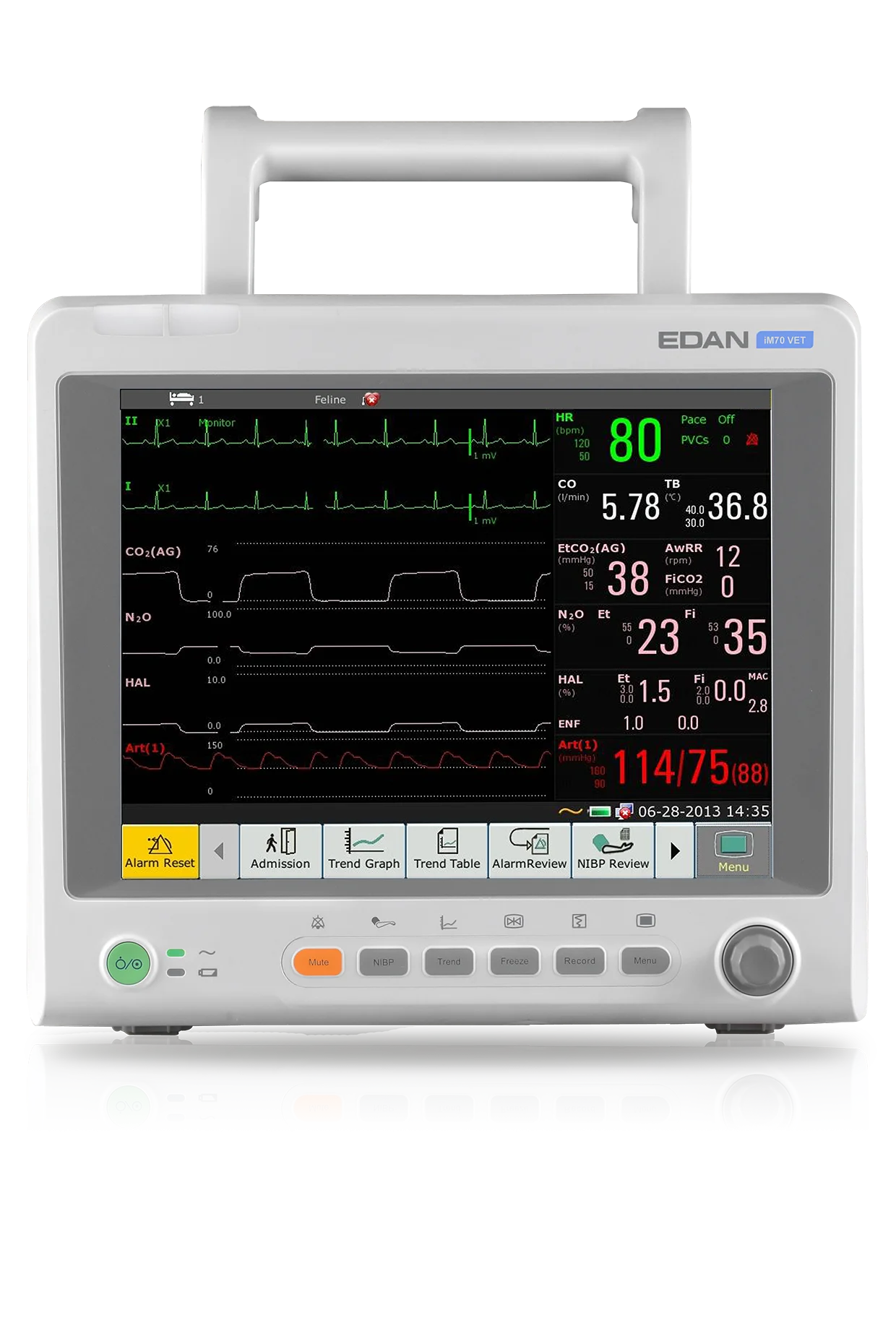 Hot Sale Advanced Edan IM70 Pet Operation Monitor Edan Vet Monitor with Best Price