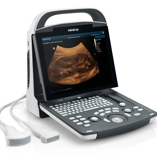 Human use Mindray DP10 Medical BW ultrasound instruments Black and White ultrasound machine With convex probe