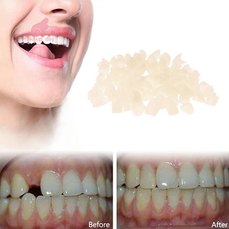 

1 Bag Dental Temporary Crown Material For Anterior/Molar Teeth Veneers Gum Protection And Stable