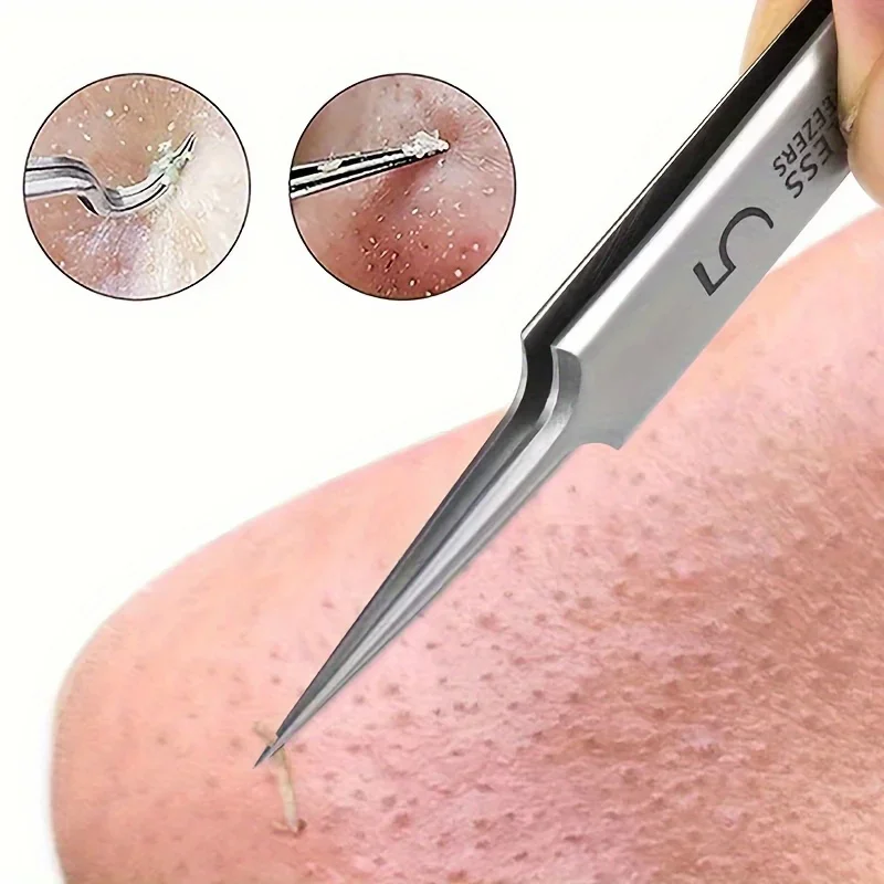 Blackhead Tweezers - Precision acne removal tool for facial whiteheads, acne, pimples - Stainless steel professional makeup tool