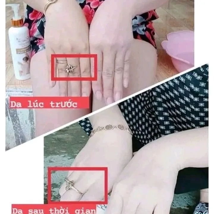 TAM TRANG LUA MACH ENINA THAI LAN ,tam la trang