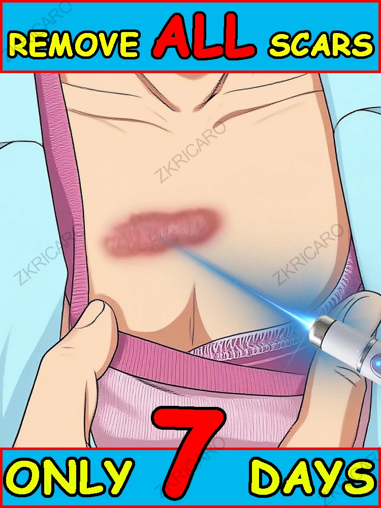 O dispositivo de luz azul resolve cicatrizes, economize sua pele!