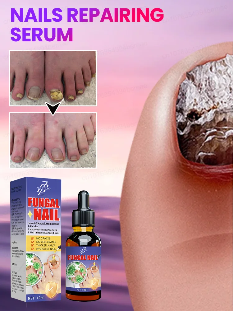 ᴿᵉᵐᵒᶜ̧ᵃ̃ᵒ ᵖʳᵒᶠⁱˢˢⁱᵒⁿᵃˡ ᵈᵒ ᶠᵘⁿᵍᵒ ᵈᵒ ᵖʳᵉᵍᵒ