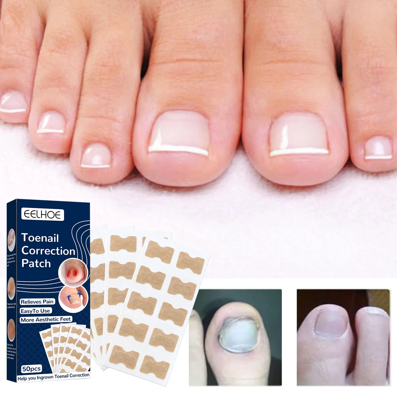 100PCS Toenail Correction Stickers Breathable Ingrown Toenail Corrector Patches Treatment Recover Corrector Pedicure Care Tools