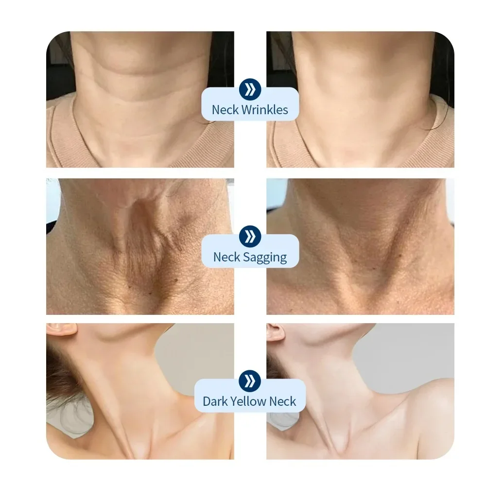 2025 Neck LED Lift Mask Photon Anti-Wrinkle Skin Tightening Neck Beauty Device Skin Brighten Rejuvenation Neck Wrinkle Remover