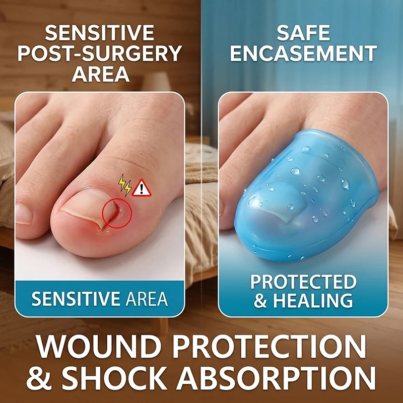 1PCS New Soft Silicone Toe Sleeves Toe Protector Reduce Friction Prevents Nail Insertion for Wound Care and Cutaneous Infections