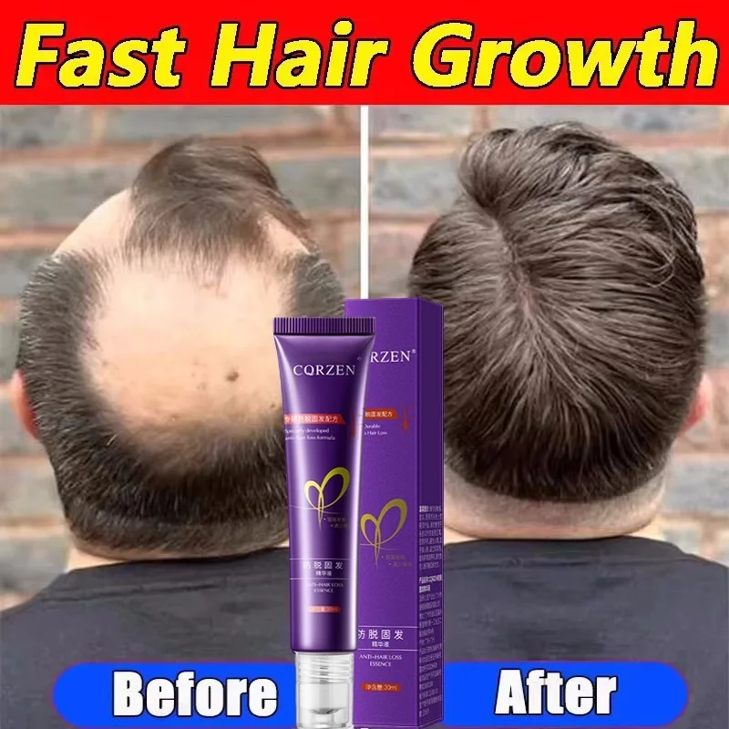 Suero para el crecimiento del cabello, cápsula esencial de crecimiento rápido de 7 días, antipérdida de cabello, reparación de calvicie, tratamiento del cuero cabelludo dañado para mujeres y hombres