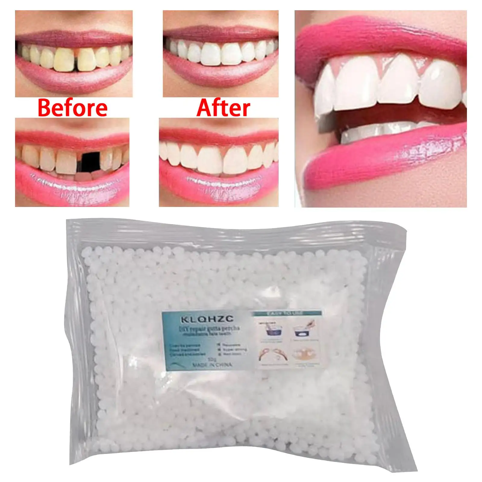 Repair Kit Repair Granules Tooth Adhesive Filling Fix The Missing Broken Tooth Thermal Fitting Beads