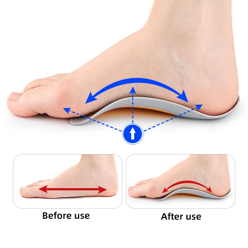 Plantar Fasciitis Insoles for Men & Women - Dual Color Arch Support, XO Leg Alignment, Flat Foot & Foot Rotation Relief