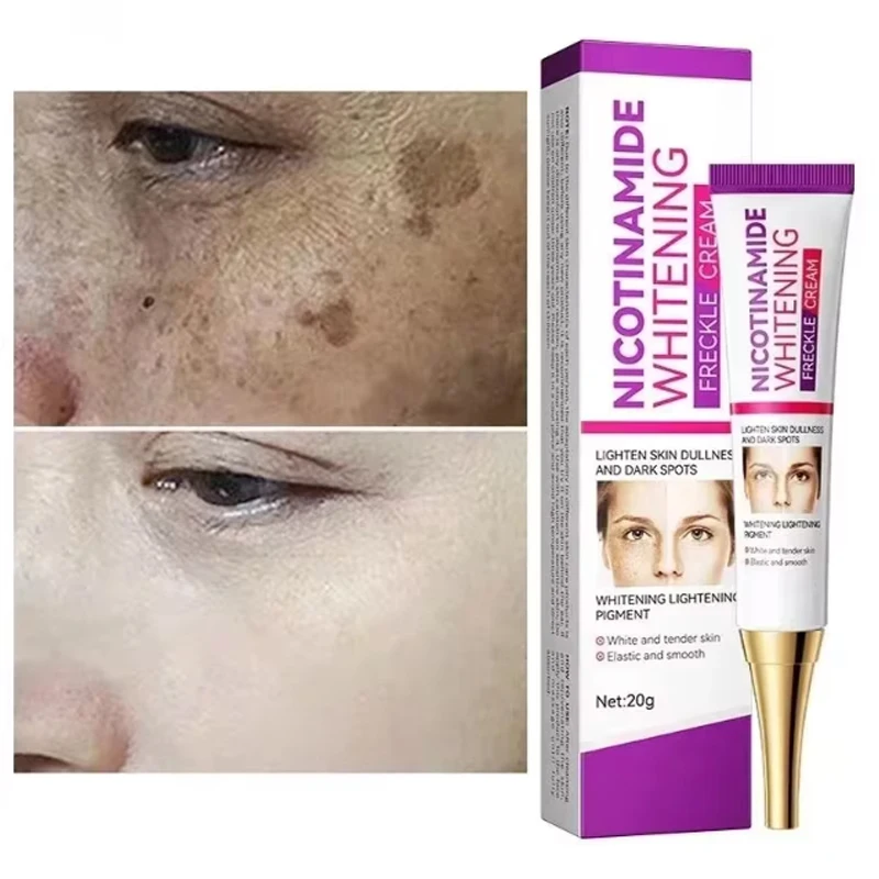 Crème blanchissante à la nicotinamide pour le visage, élimine les taches de rousseur, les taches foncées Melasma, les marques d\'acné,