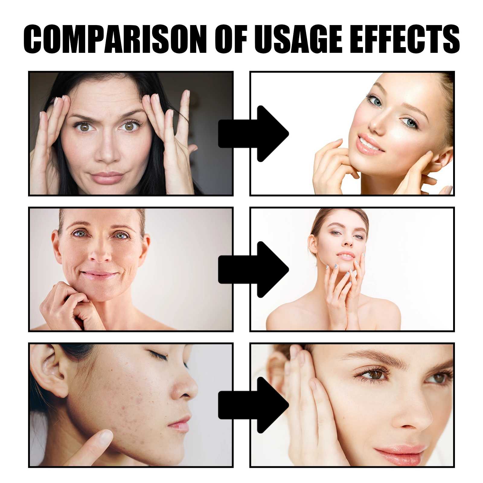 2026 Dragon Blood Cream Rejuvenation Facial Treatments Reduce Fine Lines Anti Wrinkle Tighten Skin Lifting Dragon Blood Serum