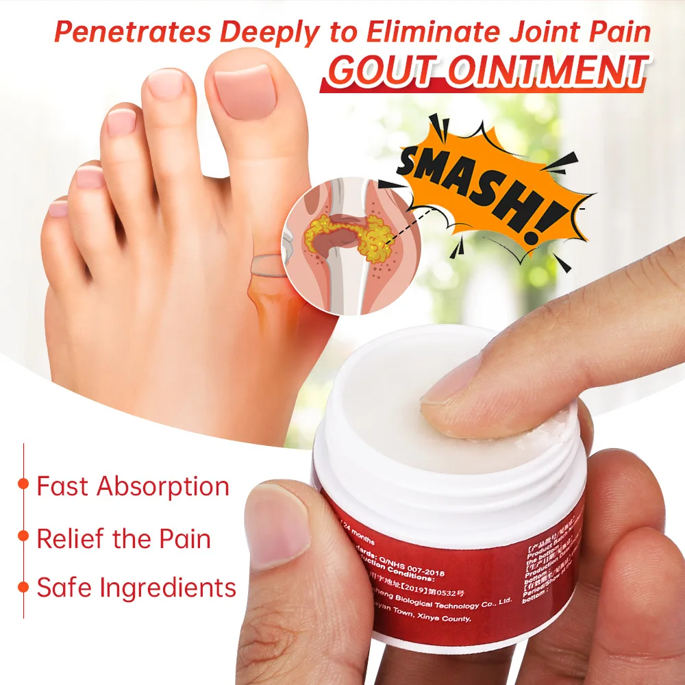 Sumifun 20g Gout Treatment Ointment Artritis Finger Bunion Toe Pain Relief Analgesic Cream Feet Care Chinese Medical Plaster