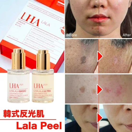 

Набор для пилинг-процедур LHALA PEEL SET: химический пилинг для лица, устранения следов от акне и ухода за кожей.
