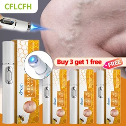 4Pcs Varicose Veins Laser Therapy Pen Improves Moderate Varicose Vein For Men Women Relieve Leg Pain Improve Blood Circulation