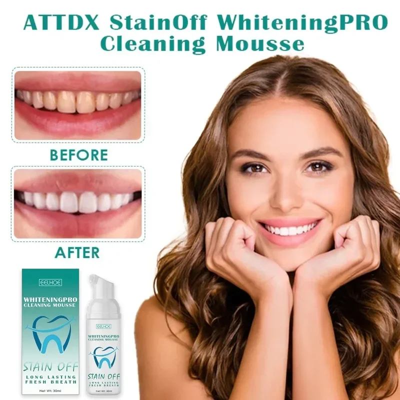 

Sdatter Teeth Whitening Mousse Deep Cleaning yellow Stains tartar removal odor oral Fresh Breath Prevent tooth decay gum care To