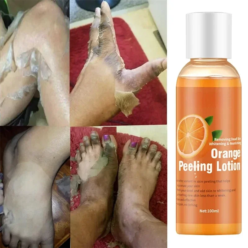 100ml Yellow Peeling Oil Bleaching Dark Skin Lighten Elbows Knees Hands Melanin Even Skin Tone Effective Whitening Body Serum