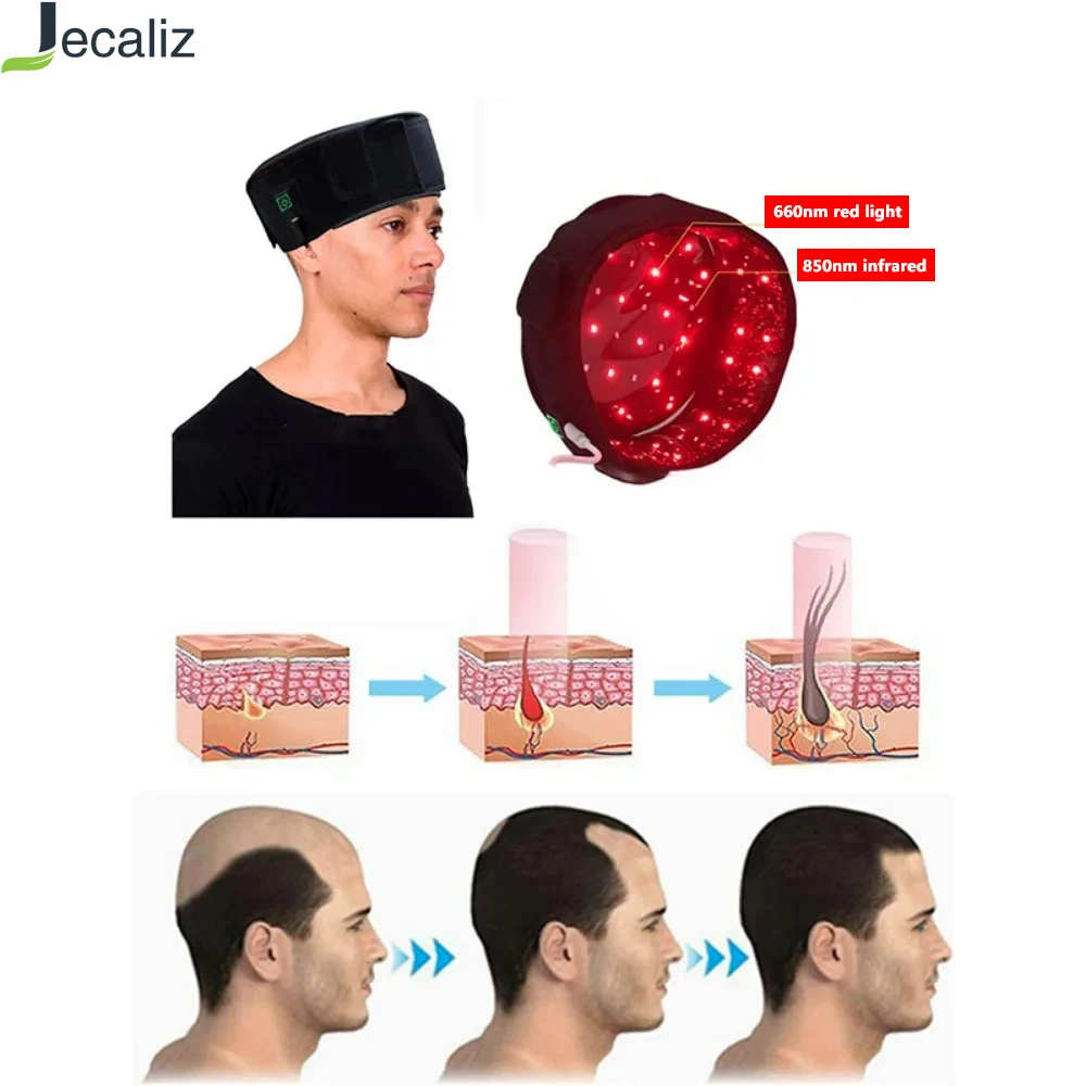 

70 шт., инфракрасная массажная шапочка красного света для наращивания волос, способствующая роста волос, шляпа, устройство 660 нм и 850 нм, USB-разъем