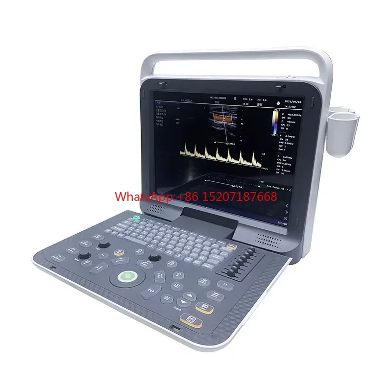 Color Doppler ultrasound diagnosis system E8 portable full digital color ultrasound imaging medical color ultrasound machine