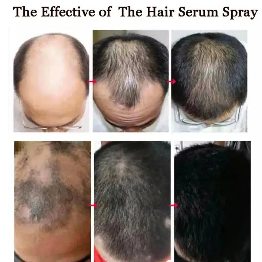 Halus pelembut nutrisi minyak rambut cair jahe jelas Formula bergizi esensi gatal alami Anti ringan halus Extrac U6U9