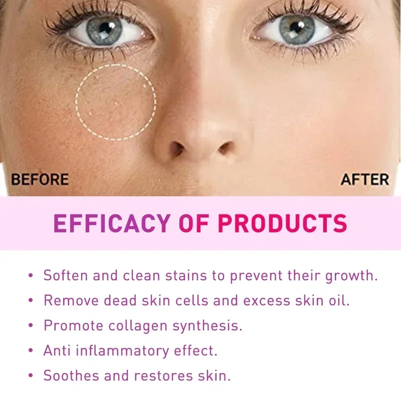 Sdotter New Remove Eye Fat Granule Essence milia spot eliminate serum Dilute eye particles fine lines eye bags Firm Anti-Aging M