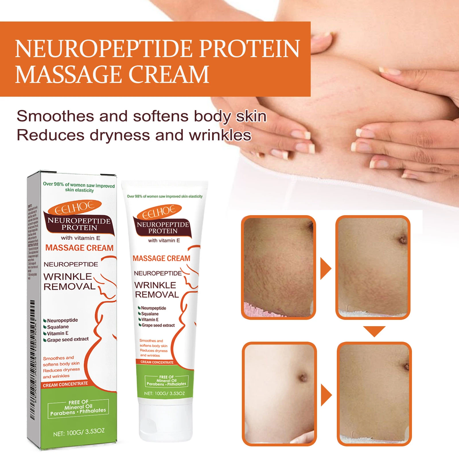 100g Stretch Marks Permanent Removal Cream Maternity Pregnant Women Pregnancy Anti-Winkle Smooth Repair Firming Skin Body Care view 4