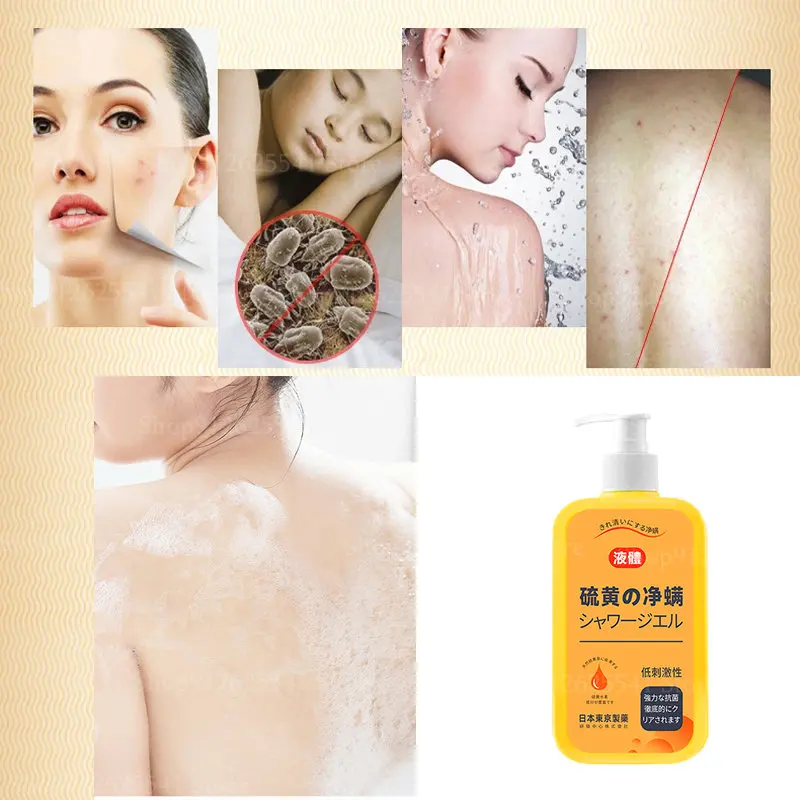 300ml Sulfur Anti-mite Liquid Soap Oil Control Acne Acne Moisturizing Net Mite Sulfur Body Wash Relief for Sensitive Skin