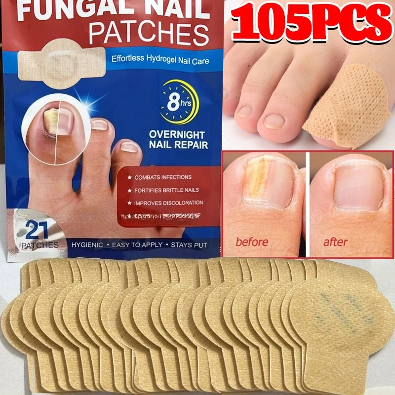 105/21 قطعة مسمار الفطريات التصحيح مقاوم للماء مسمار رقعة إصلاحية نام تصحيح ملصق التالفة مسمار رمادي الرعاية التصحيح قدم أدوات العناية