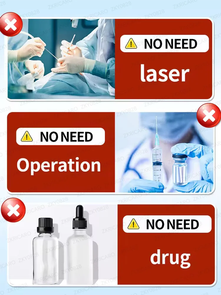 كريم إزالة الوشم السريع يخفف إزالة الوشم بشكل دائم