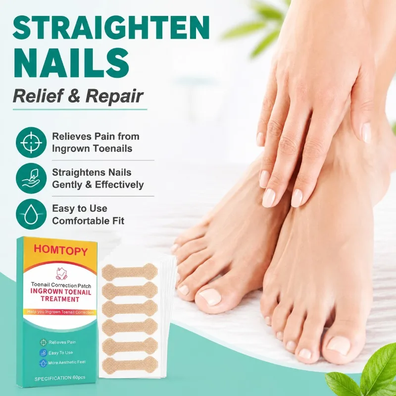 Ingrown Toenail Correction Patch Professional Paronychia Repair Sticker Elastic Nail Straightening Strip Relieve Inward Growth