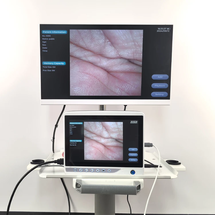 Professional Supply Hot Sales Flexible Veterinary Endoscope Veterinary Bronchoscope System