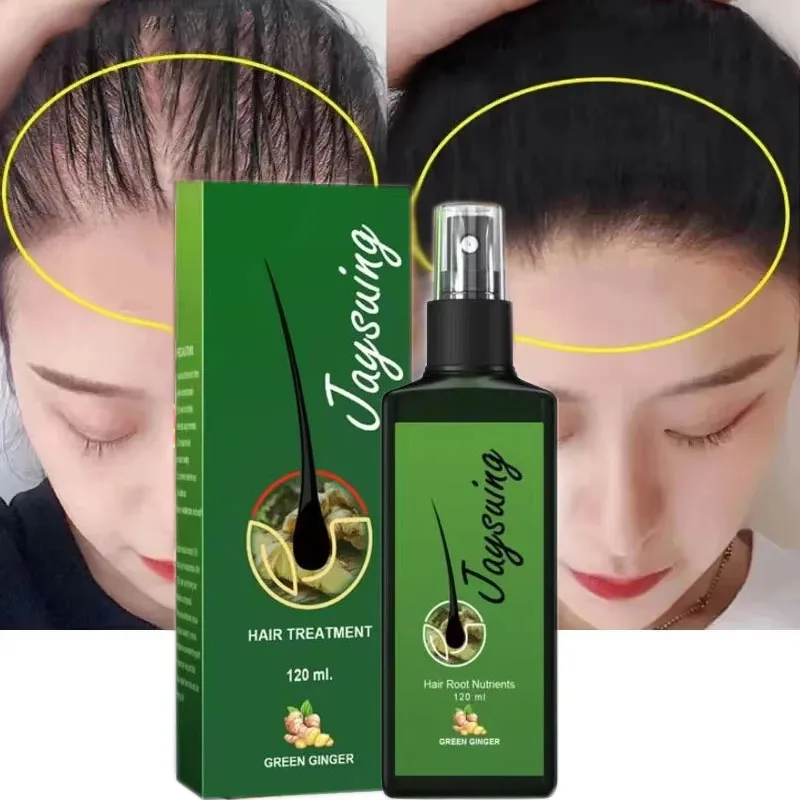 

Fast Hair Growth Serum Spray Ginger Extract Prevent Hair Loss Anti Baldness Treatment Scalp Hair Follicle Hair Care Products