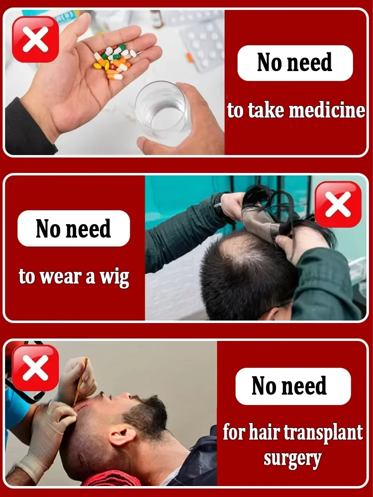 Densificazione dei capelli, crescita rapida, densificazione dei capellicrescita rapidadispositivo anti-stripping maschile e femminile