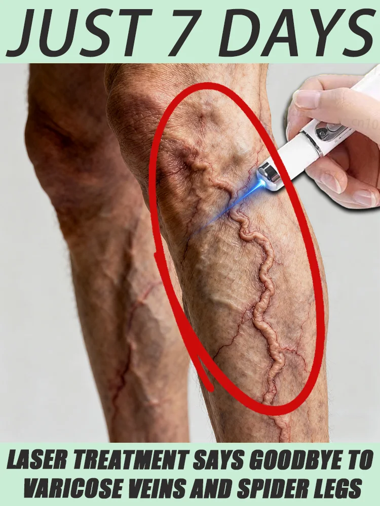 静脈瘤レーザー治療、先進機器、無痛蜘蛛状血管治療