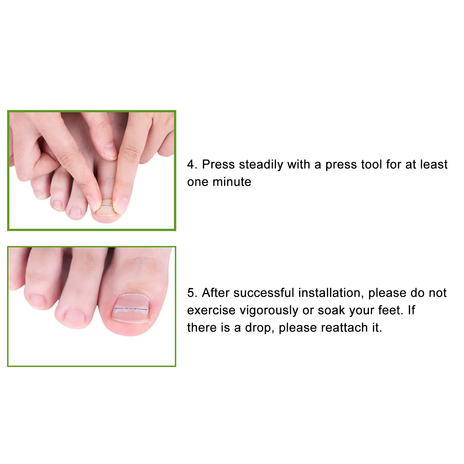 10 pz Strisce di Correzione dell'unghia del piede Brace Elastico Cambio Direzione della crescita Tutore di Correzione dell'unghia del piede incarnita Strisce di correzione dell'unghia del piede