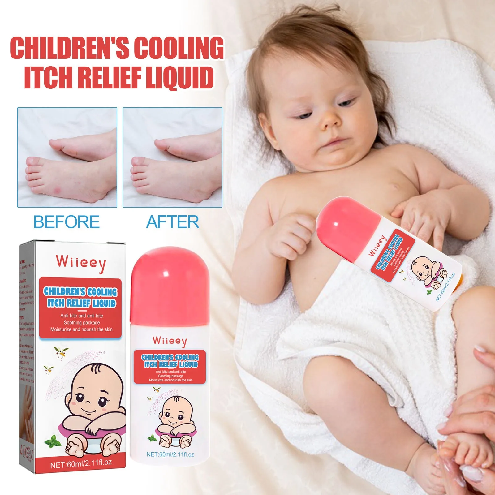 Children\'s Cool And Anti-Itch Lotion, Use For Mosquito Bites And Skin Itching, MosquitoRepellent And Cool And Anti-Itch Lotion