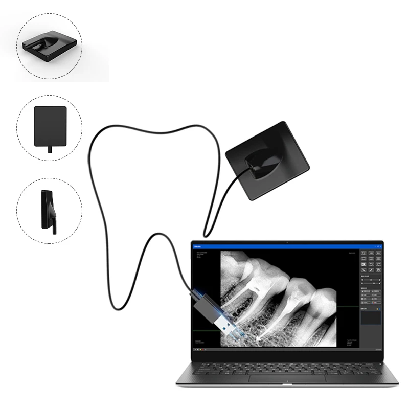 High Quality ISO Certified Dental RVG with USB Interface Electricity Powered Plastic X-Ray Sensor Dental Clinics Cheap Price