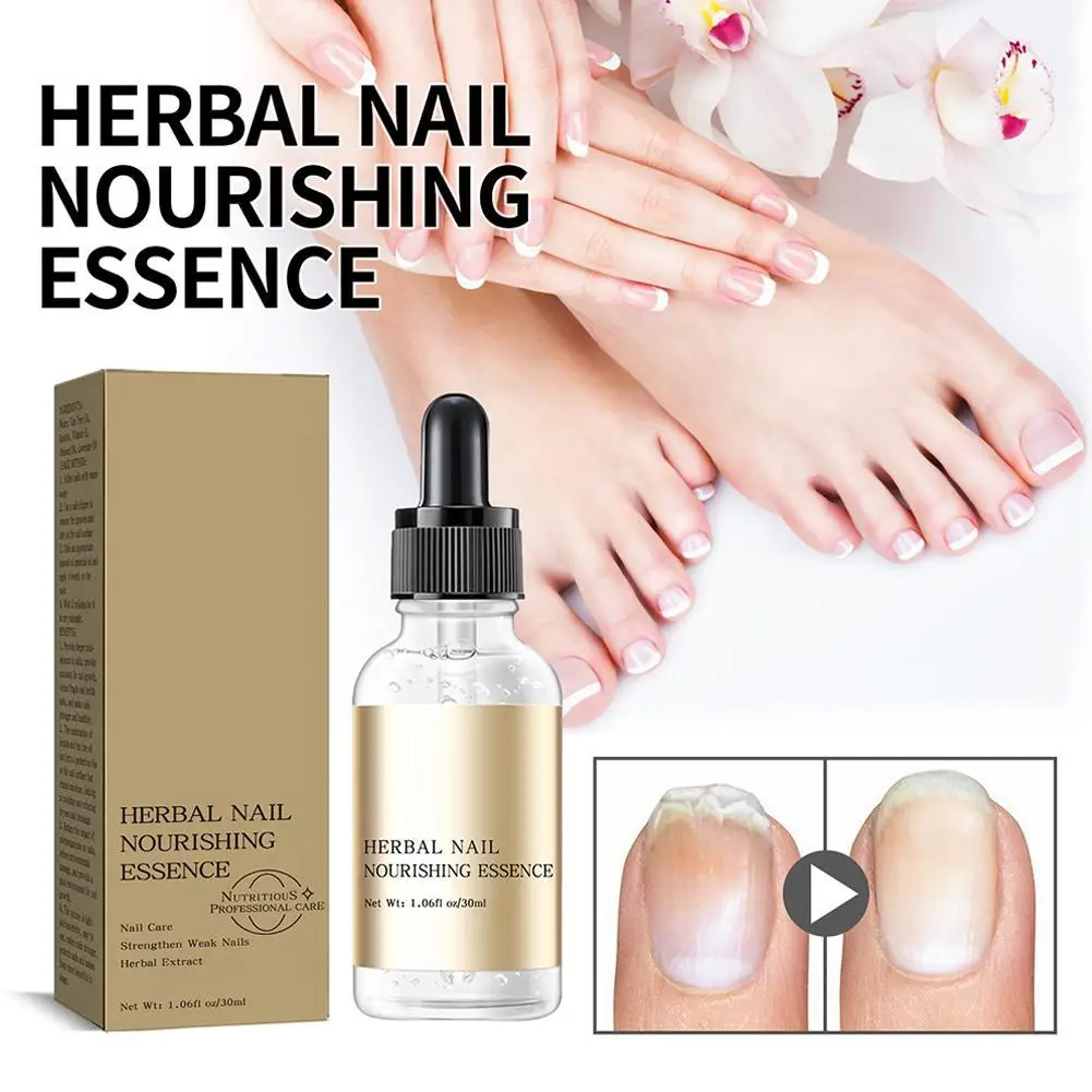 30ml Fungal Repair Liquid Nail Care Essential Oil Hand And Foot Whitening Toenail Fungus Removal Infection Care Fingers