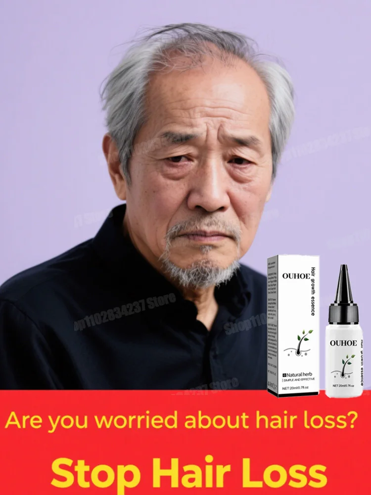 

Fast Hair Growth Oil Baldness Repair Hereditary Hair Loss Postpartum Hair Loss Seborrheic Oil