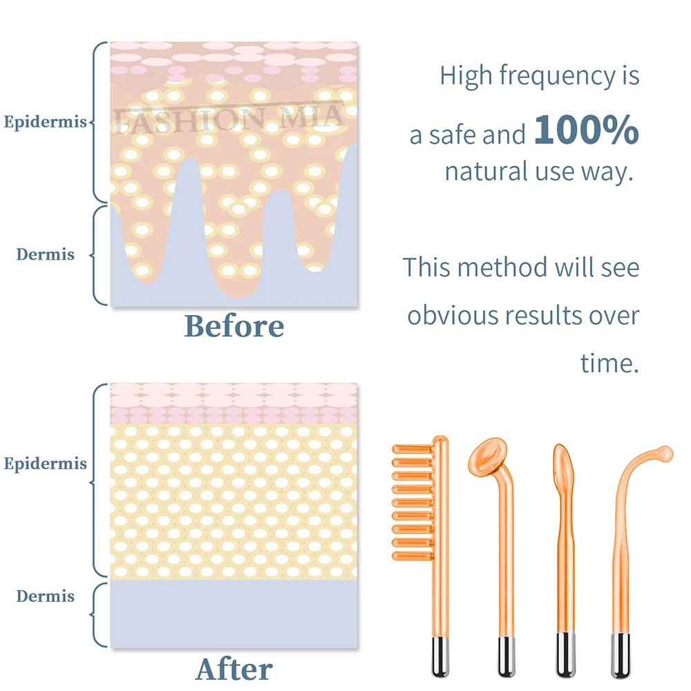 Baguette de thérapie qualifiée ale pour appareil de beauté spa, électrothérapie au néon pour la maison, tube en verre, élimination des taches d'acné, électrode morte élevée, 4 en 1