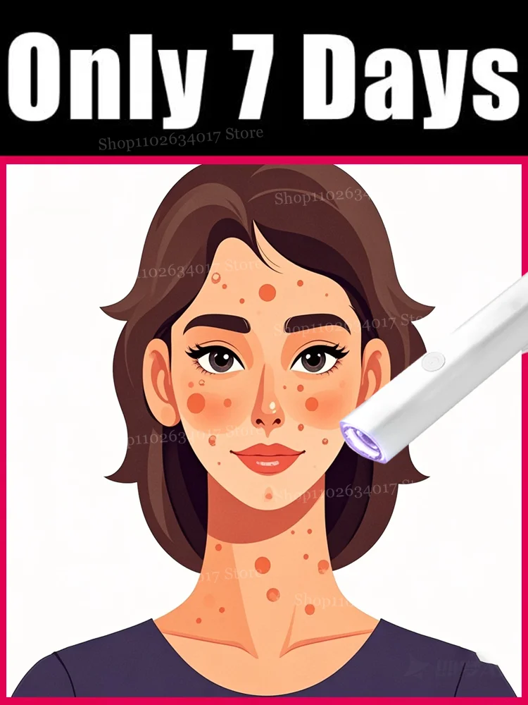 

2nd ᵍᵉⁿᵉʳᵃᵗⁱᵒⁿ ᵘᵖᵍʳᵃᵈᵉᵈ wᵃʳᵗ ⸴ ᑫᵘⁱᶜᵏˡʸ， ʳᵉpᵃⁱʳ wᵃʳᵗˢ ʳᵒoᵗ