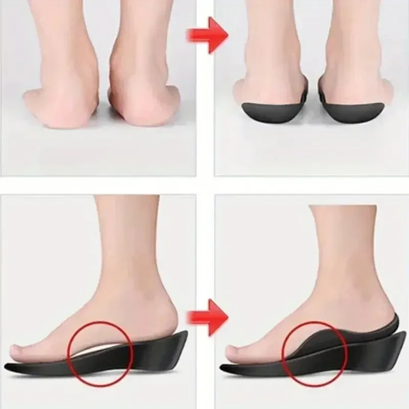 1 Pair Arch Support Inserts - Comfortable TPR Material, Ideal for Men & Women, Universal Fit, Promotes Proper Foot Alignment